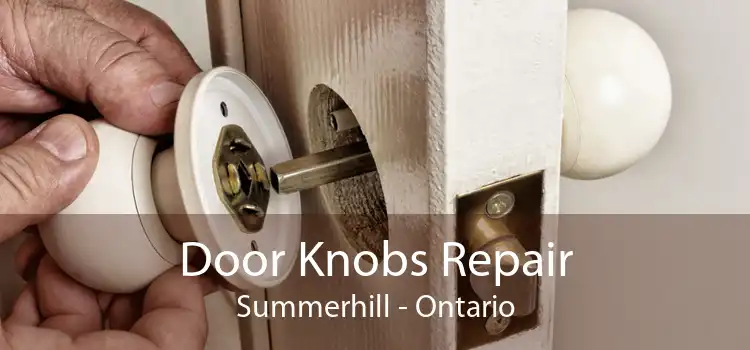 Door Knobs Repair Summerhill - Ontario